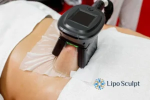 Does Fat Freezing At Home Work? 3 Fat freezing at home from Lipo Sculpt Stratford